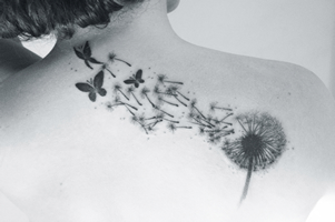 rimozione tatuaggi con il laser